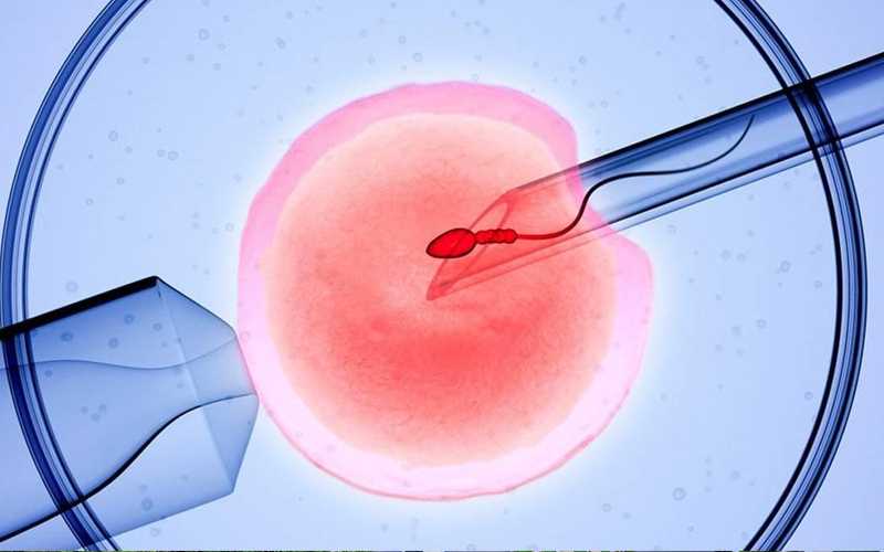 揭示子宫内膜异位症的根源与成因